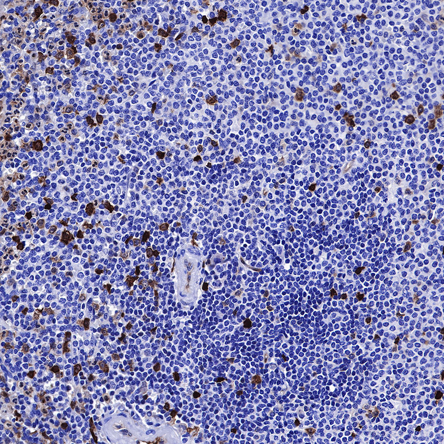 Rabbit anti-Stathmin 1 Recombinant Monoclonal Antibody(383-4)