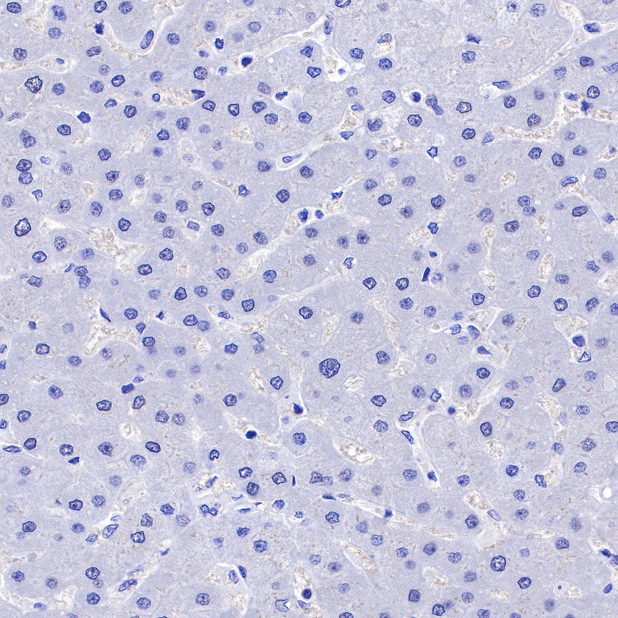 Rabbit anti-HCG-β Recombinant Monoclonal Antibody(228-46)
