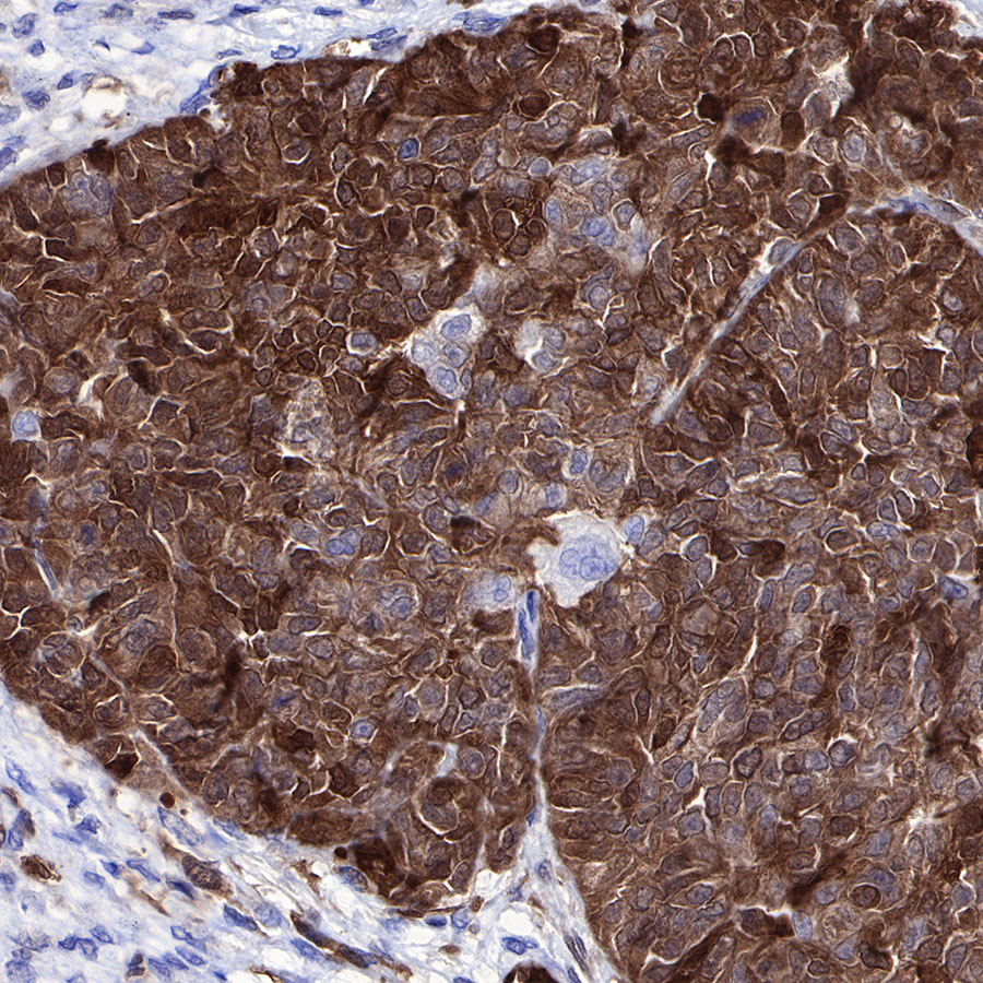 Rabbit anti-Stathmin 1 Recombinant Monoclonal Antibody(383-4)