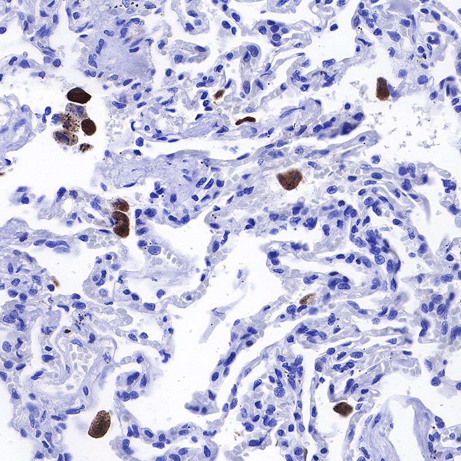 Rabbit anti-iNOS Recombinant Monoclonal Antibody(R131)