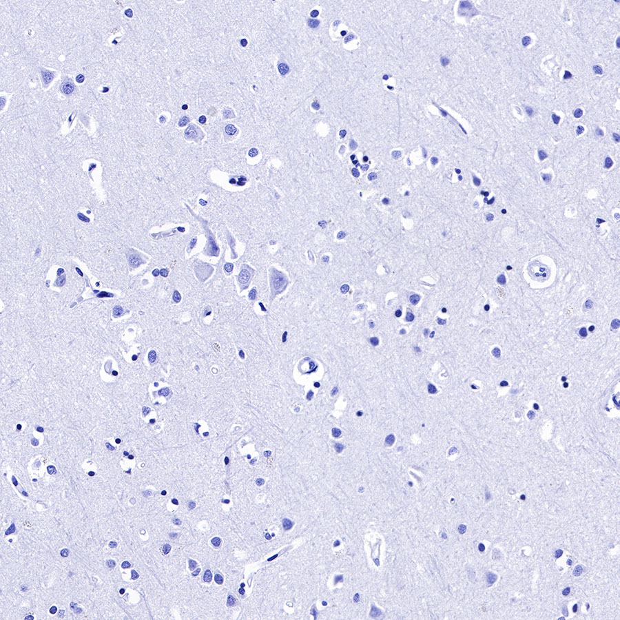 Rabbit anti-HCG-β Recombinant Monoclonal Antibody(228-46)