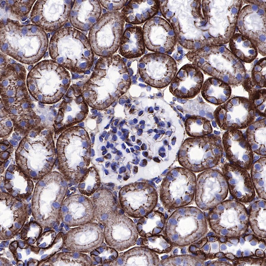 Rabbit anti-β-Catenin Recombinant Monoclonal Antibody(336-23)