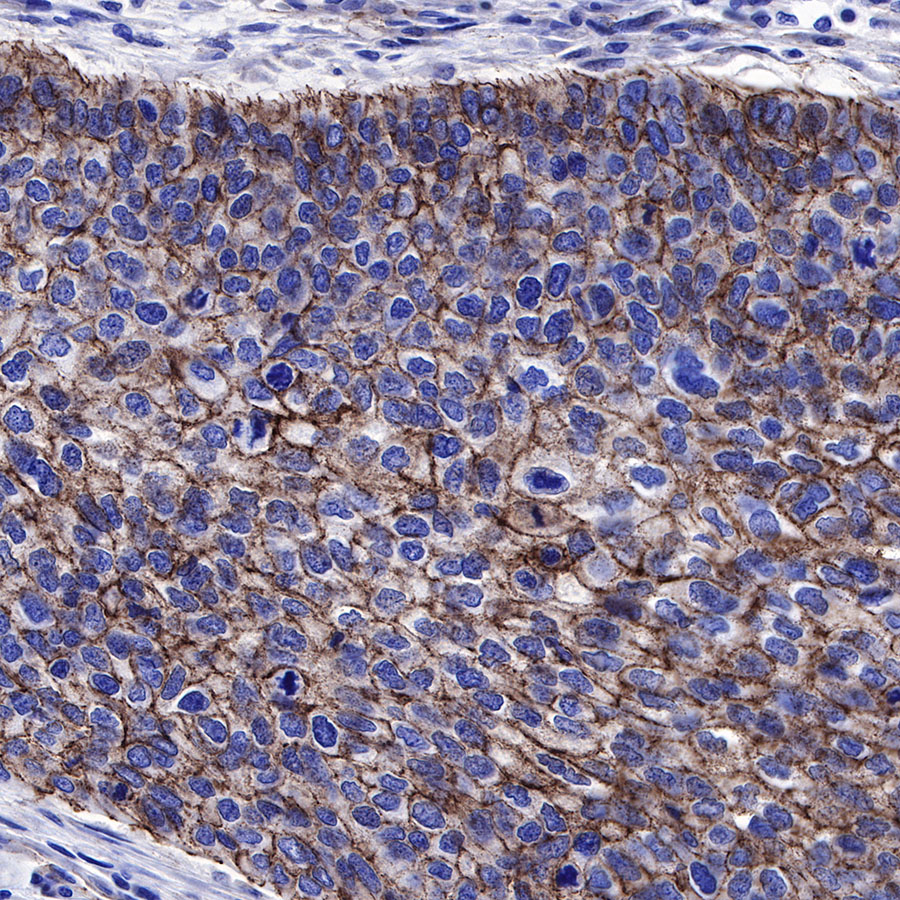 Rabbit anti-β-Catenin Recombinant Monoclonal Antibody(336-23)