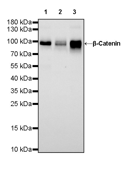 Rabbit anti-β-Catenin Recombinant Monoclonal Antibody(336-23)