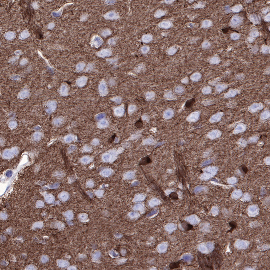 Rabbit anti-Stathmin 1 Recombinant Monoclonal Antibody(383-4)
