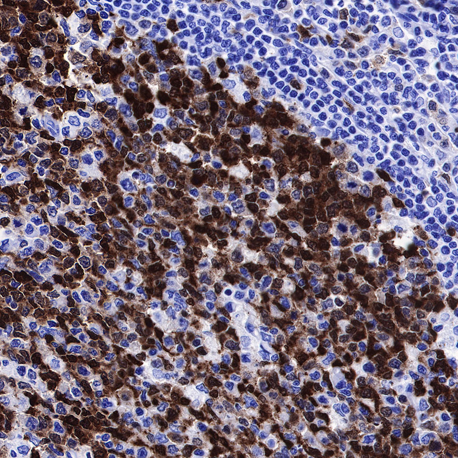 Rabbit anti-Stathmin 1 Recombinant Monoclonal Antibody(383-4)