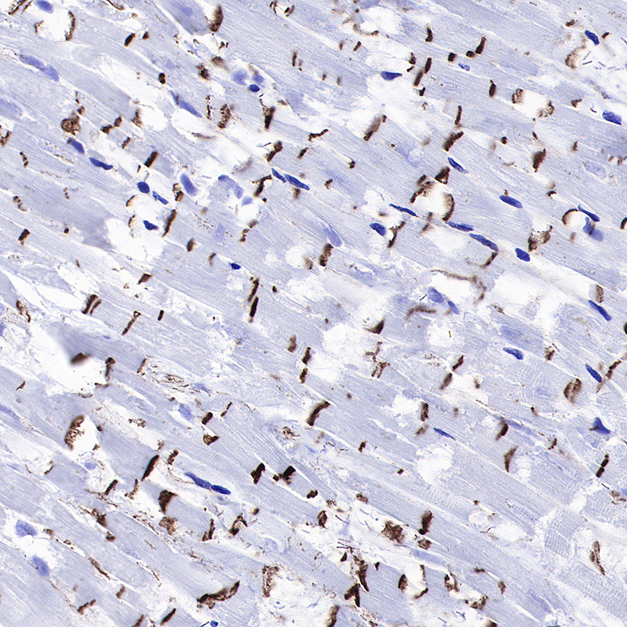 Rabbit anti-β-Catenin Recombinant Monoclonal Antibody(336-23)