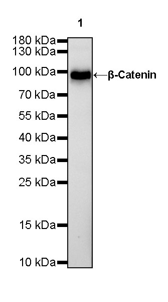Rabbit anti-β-Catenin Recombinant Monoclonal Antibody(336-23)