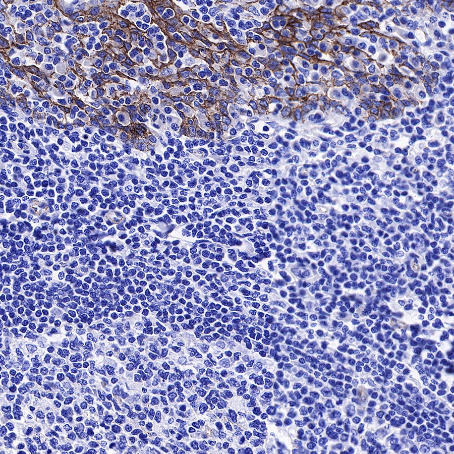 Rabbit anti-β-Catenin Recombinant Monoclonal Antibody(336-23)