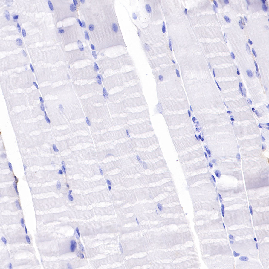 Rabbit anti-F4/80 Recombinant Monoclonal Antibody(313-49)