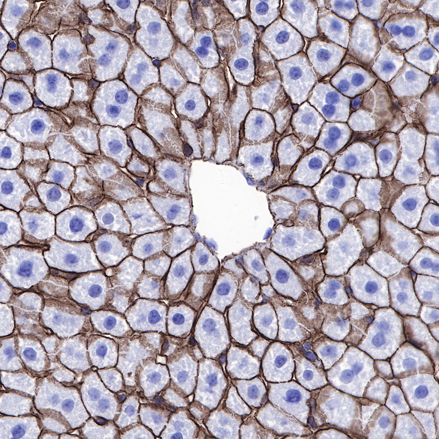 Rabbit anti-β-Catenin Recombinant Monoclonal Antibody(336-23)