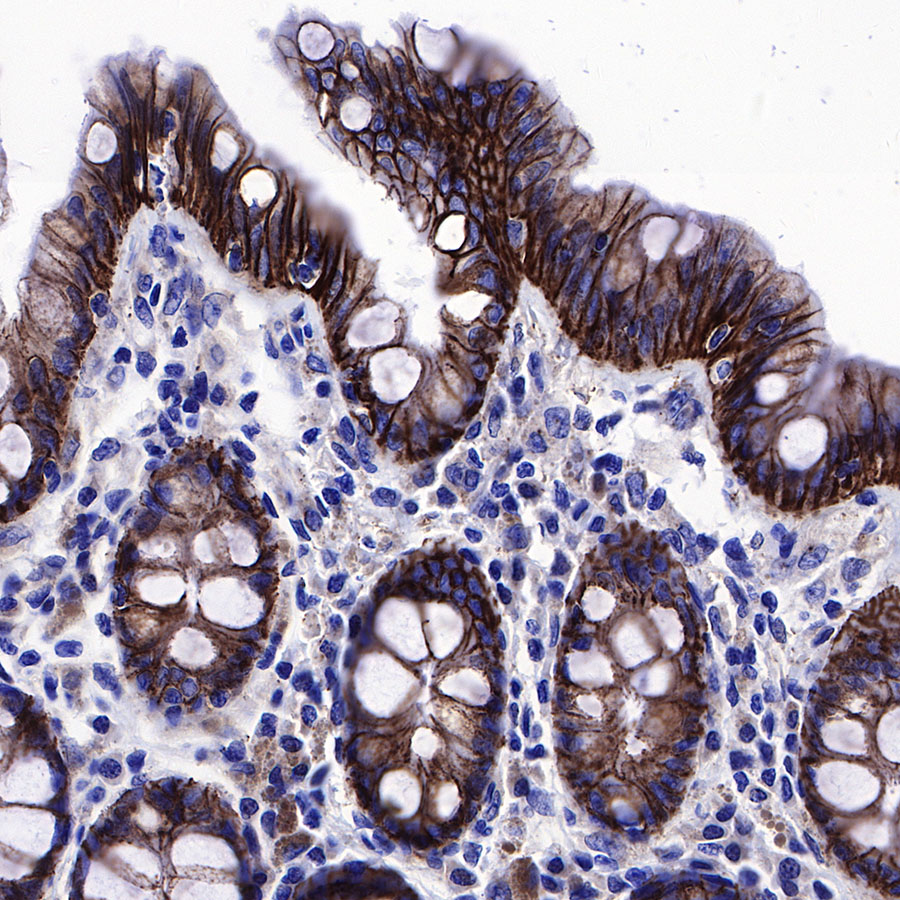 Rabbit anti-β-Catenin Recombinant Monoclonal Antibody(336-23)