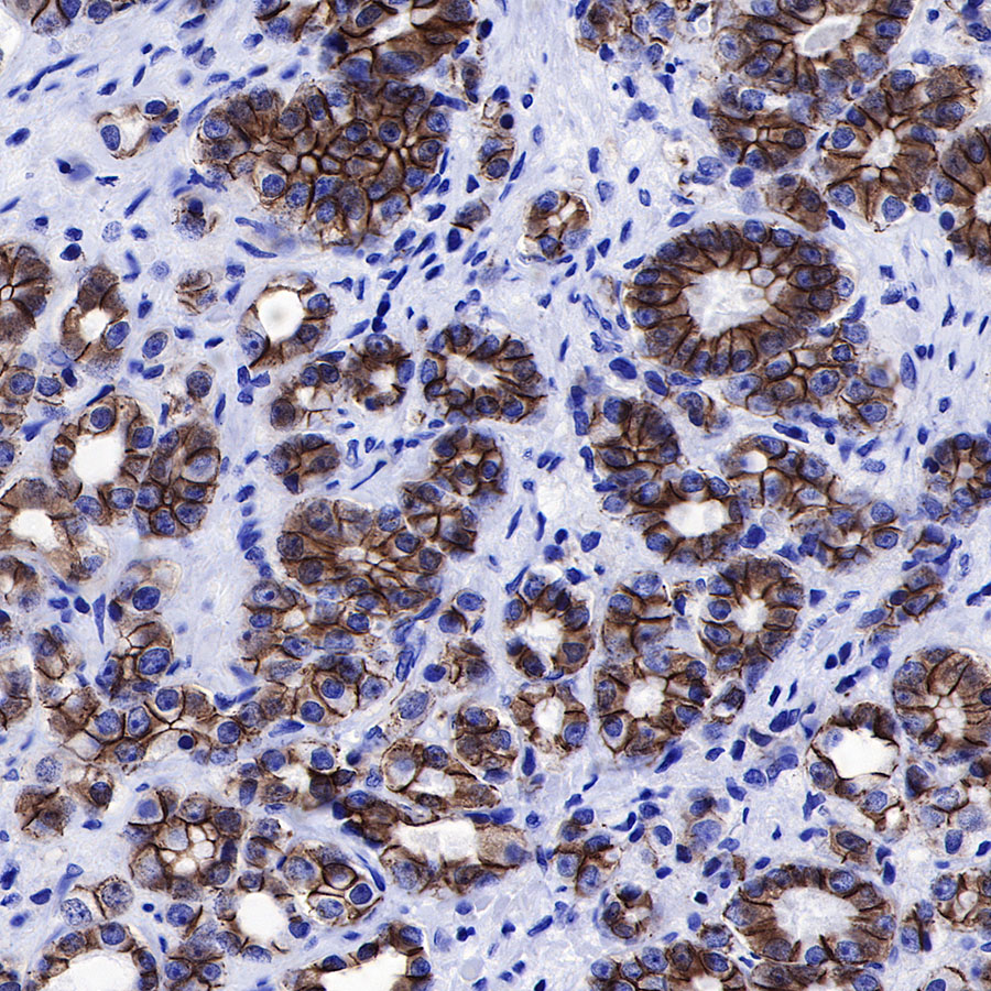 Rabbit anti-β-Catenin Recombinant Monoclonal Antibody(336-23)