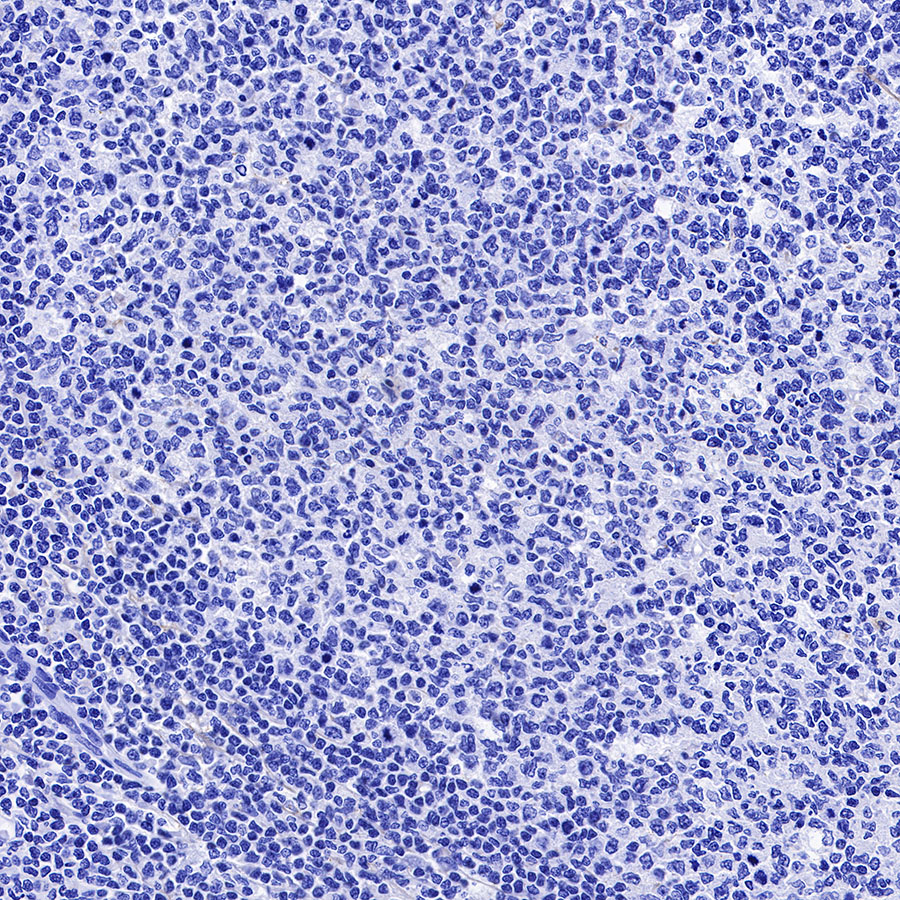 Rabbit anti-HCG-β Recombinant Monoclonal Antibody(228-46)