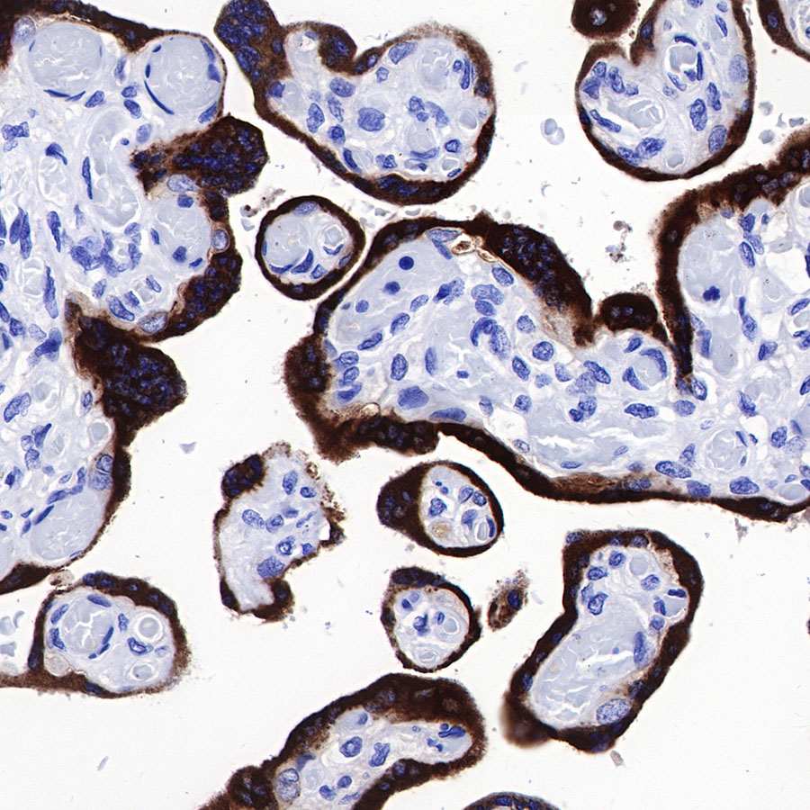 Rabbit anti-HCG-β Recombinant Monoclonal Antibody(228-46)