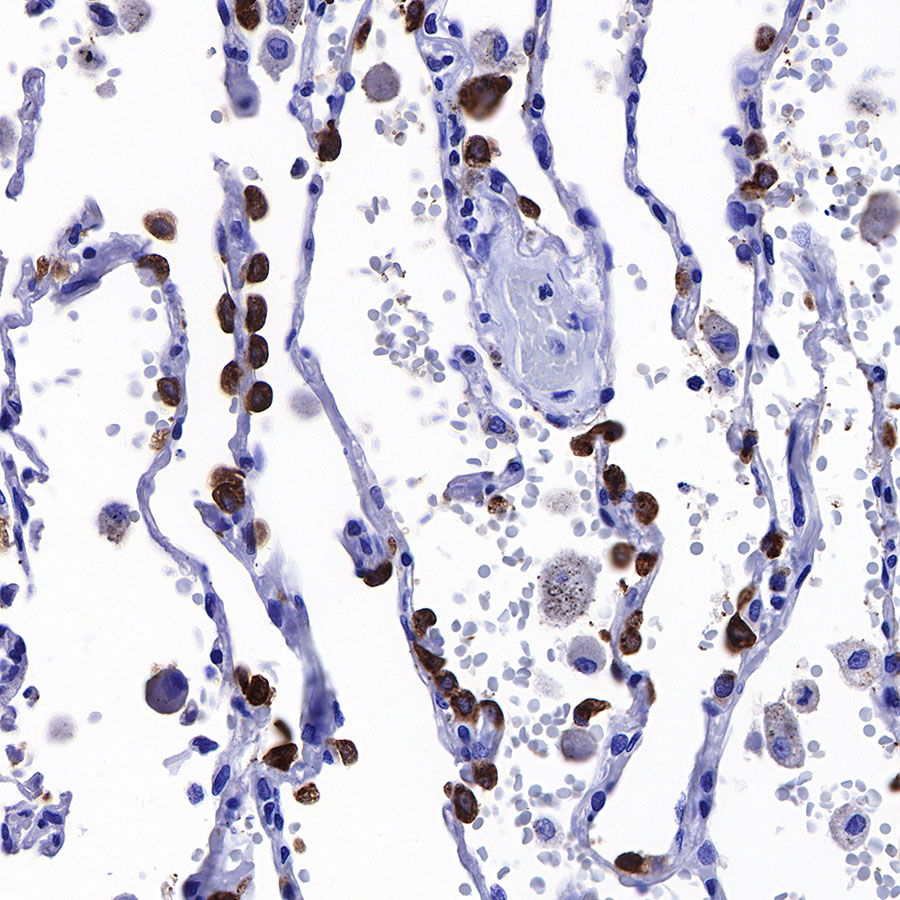 Rabbit anti-Surfactant Protein B Recombinant Monoclonal Antibody(435-18)