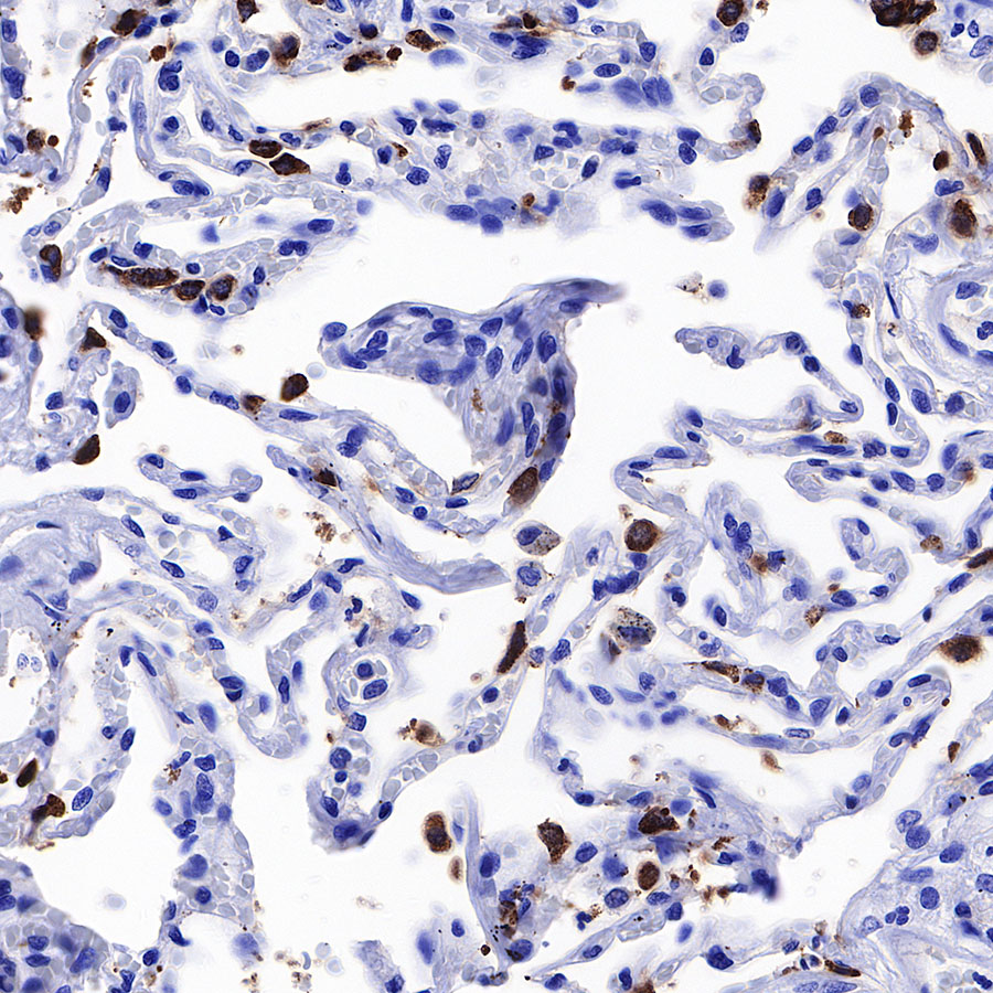 Rabbit anti-Surfactant Protein B Recombinant Monoclonal Antibody(435-18)