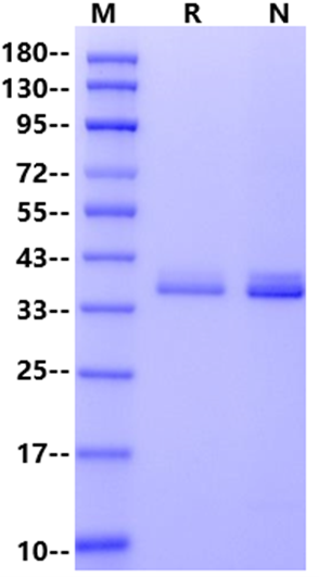 Recombinant Human APOE4 Protein(His Tag)