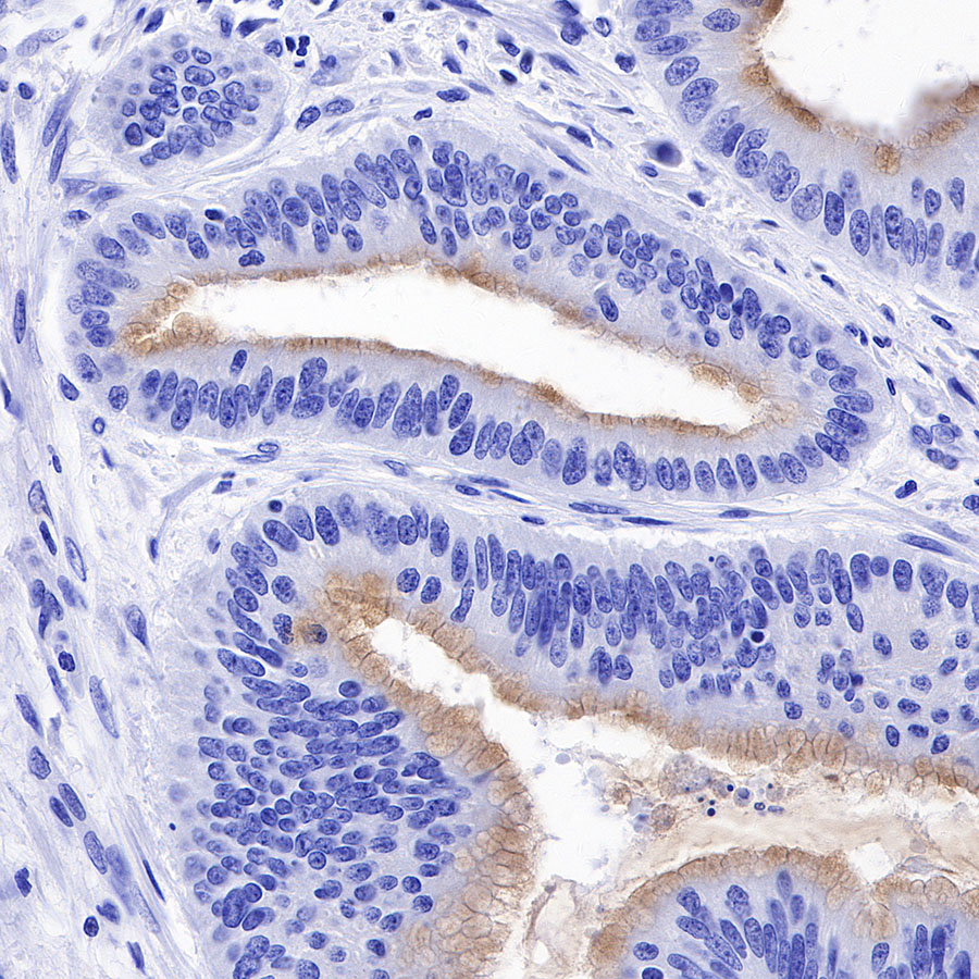 Rabbit anti-MUC2 Recombinant Monoclonal Antibody(345-9)