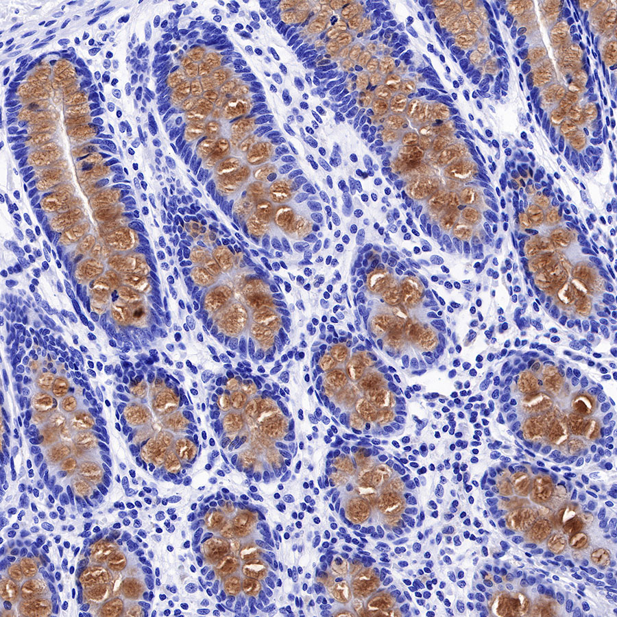 Rabbit anti-MUC2 Recombinant Monoclonal Antibody(345-9)
