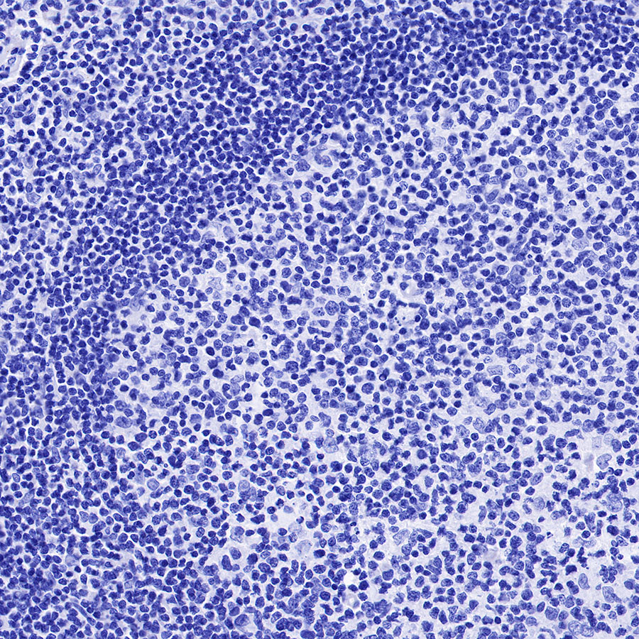 Rabbit anti-MUC2 Recombinant Monoclonal Antibody(345-9)