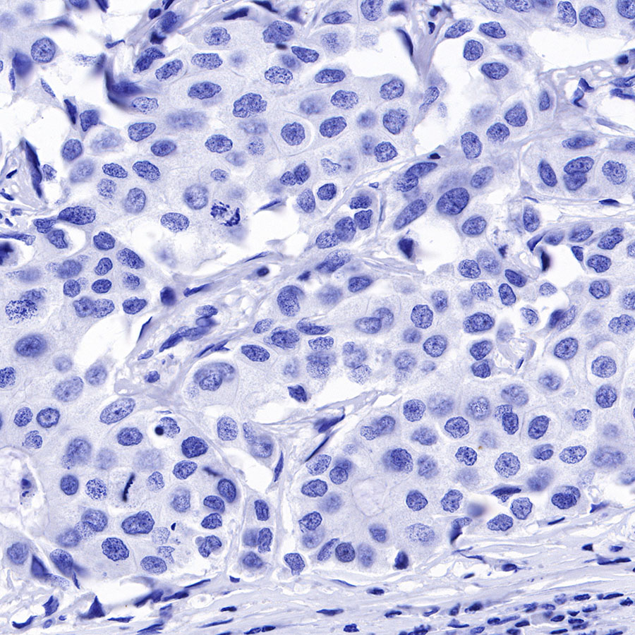 Rabbit anti-MUC2 Recombinant Monoclonal Antibody(345-9)
