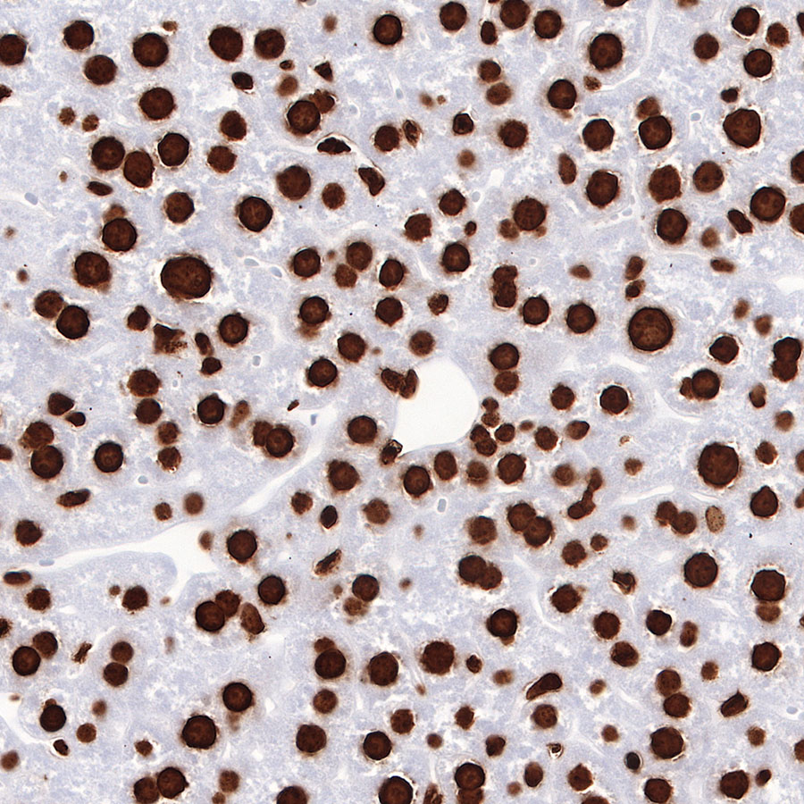 Rabbit anti-H3K27me3 Recombinant Monoclonal Antibody(431-118)