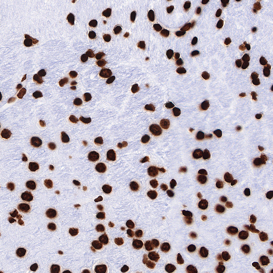 Rabbit anti-H3K27me3 Recombinant Monoclonal Antibody(431-118)