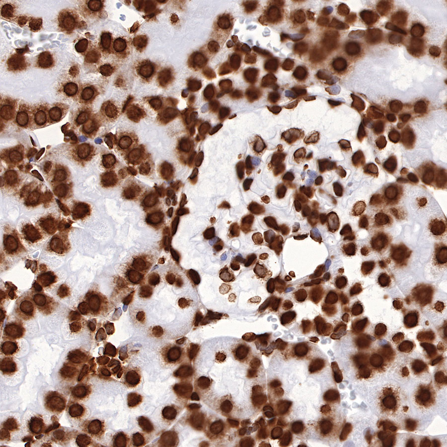 Rabbit anti-H3K27me3 Recombinant Monoclonal Antibody(431-118)