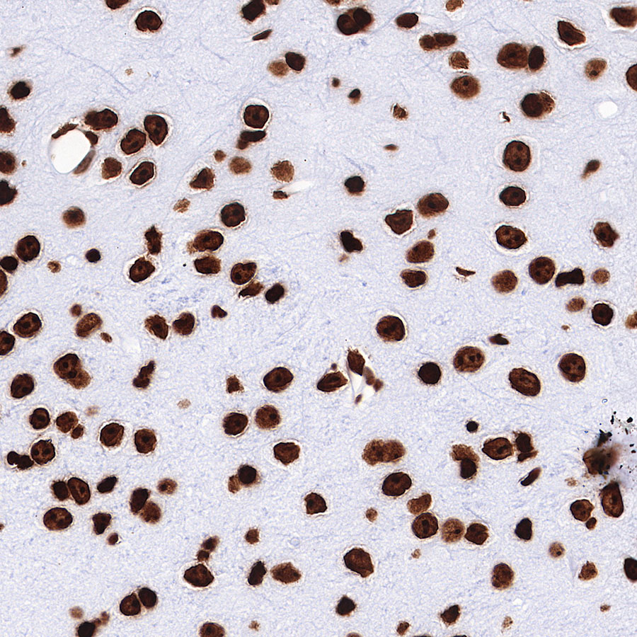 Rabbit anti-H3K27me3 Recombinant Monoclonal Antibody(431-118)