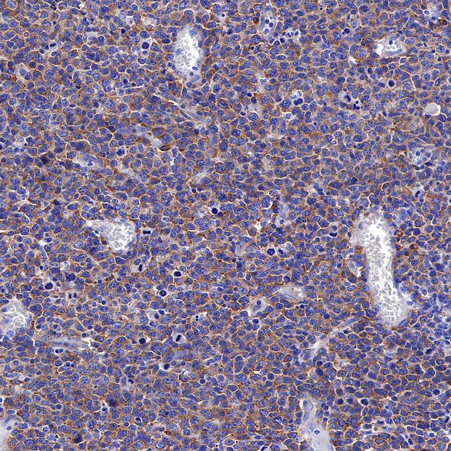 Rabbit anti-S6 Ribosomal Protein Recombinant Monoclonal Antibody(S-479-1)