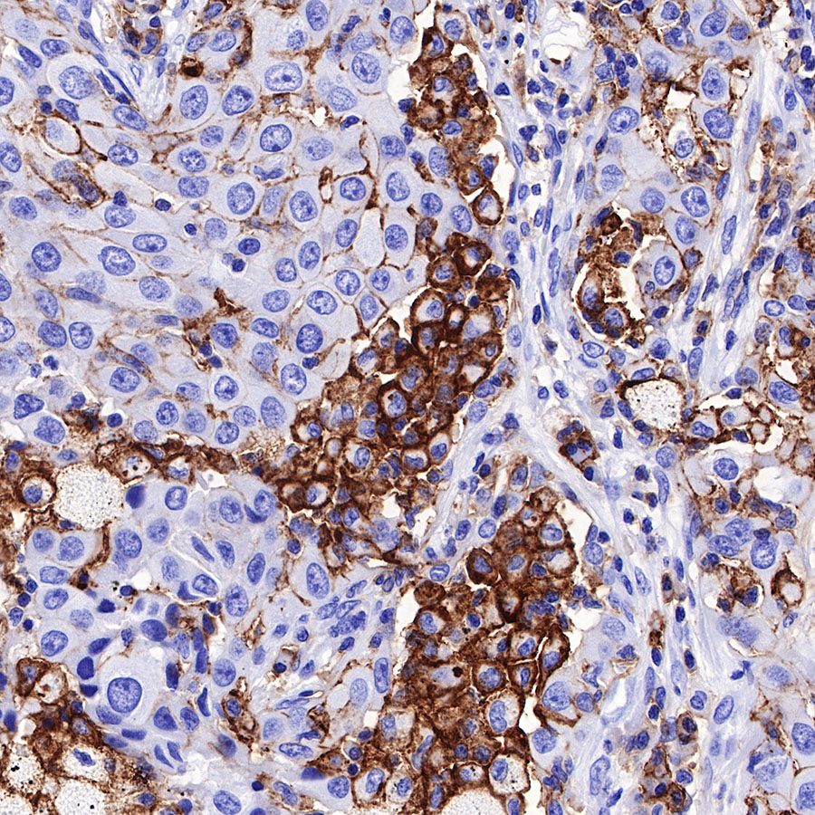 Rabbit anti-CD44 Recombinant Monoclonal Antibody(R107)