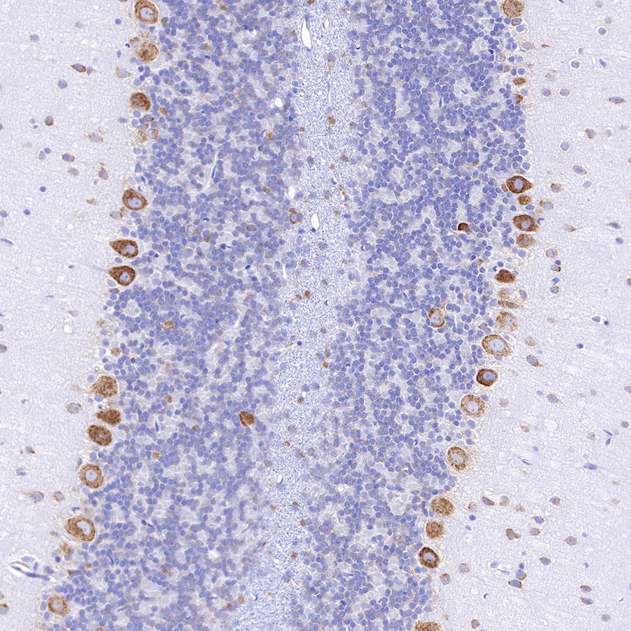 Rabbit anti-S6 Ribosomal Protein Recombinant Monoclonal Antibody(S-479-1)