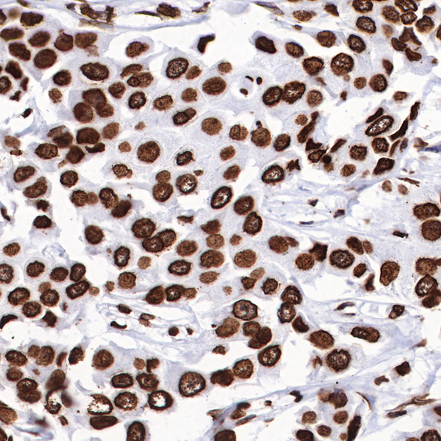 Rabbit anti-H3K27me3 Recombinant Monoclonal Antibody(431-118)
