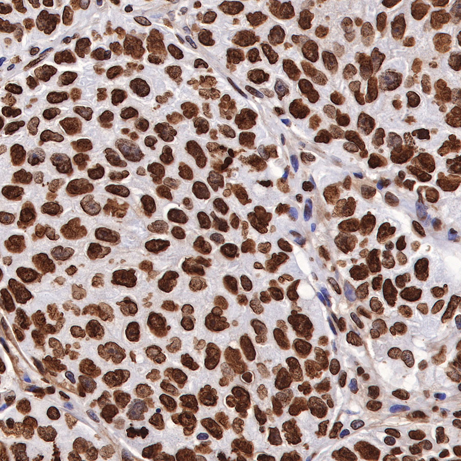 Rabbit anti-H3K27me3 Recombinant Monoclonal Antibody(431-118)