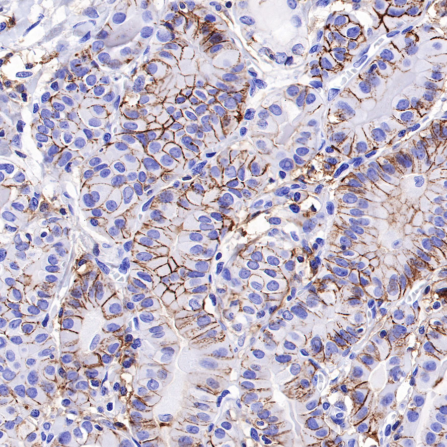 Rabbit anti-CD44 Recombinant Monoclonal Antibody(R107)