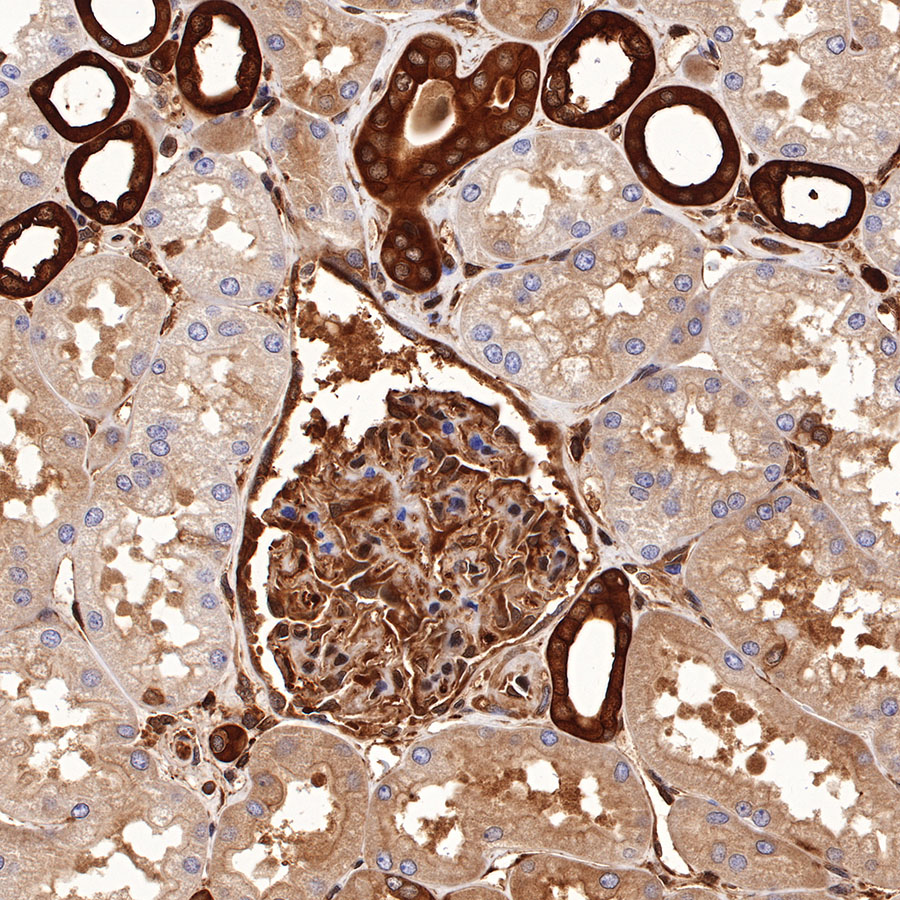 Rabbit anti-p38 MAPK Recombinant Monoclonal Antibody(S-508-19)