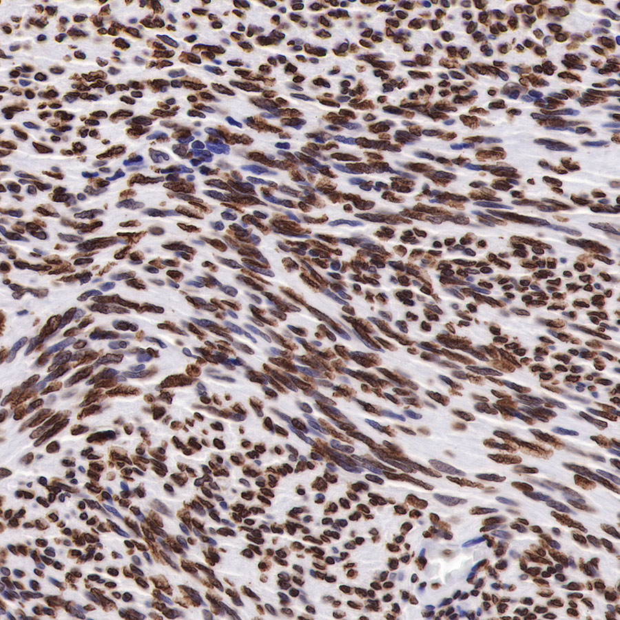 Rabbit anti-H3K27me3 Recombinant Monoclonal Antibody(431-118)