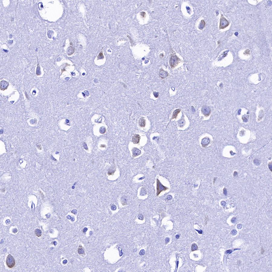 Rabbit anti-S6 Ribosomal Protein Recombinant Monoclonal Antibody(S-479-1)