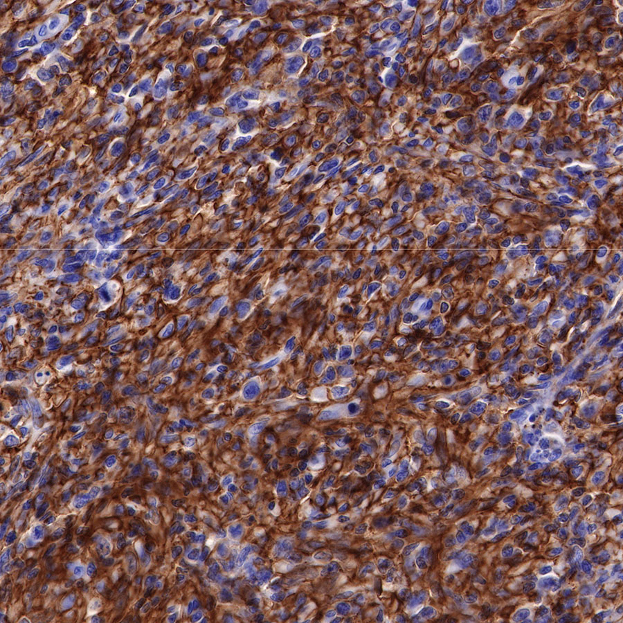 Rabbit anti-CD44 Recombinant Monoclonal Antibody(R107)