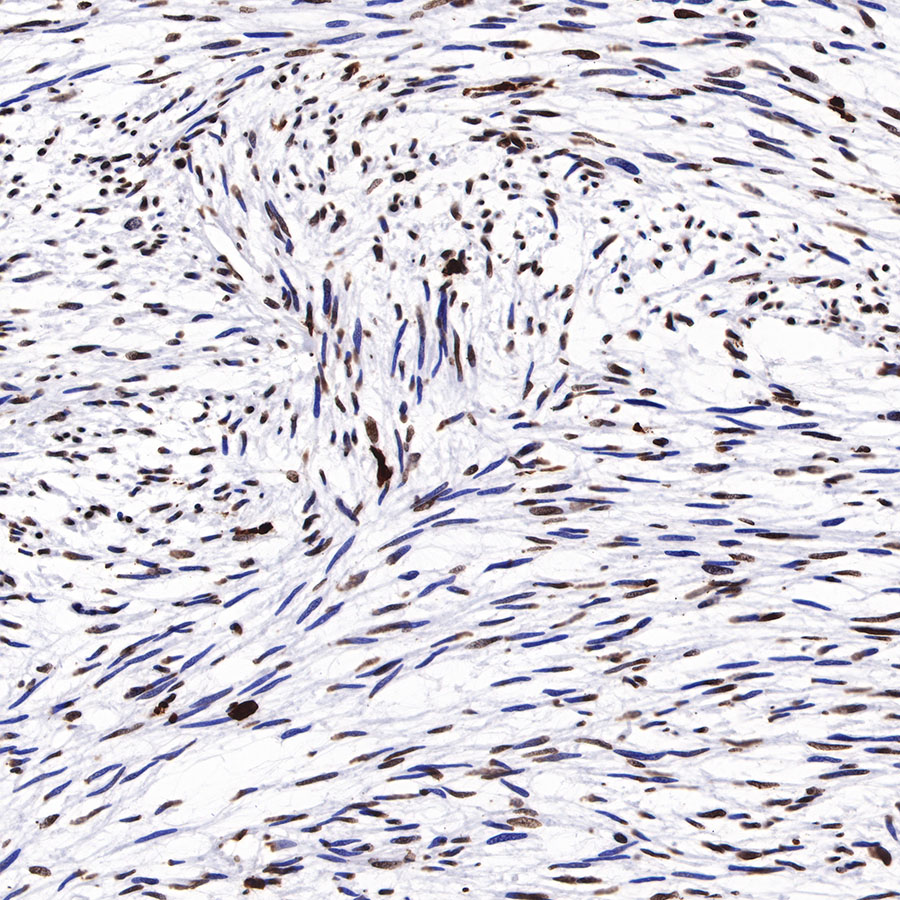 Rabbit anti-H3K27me3 Recombinant Monoclonal Antibody(431-118)