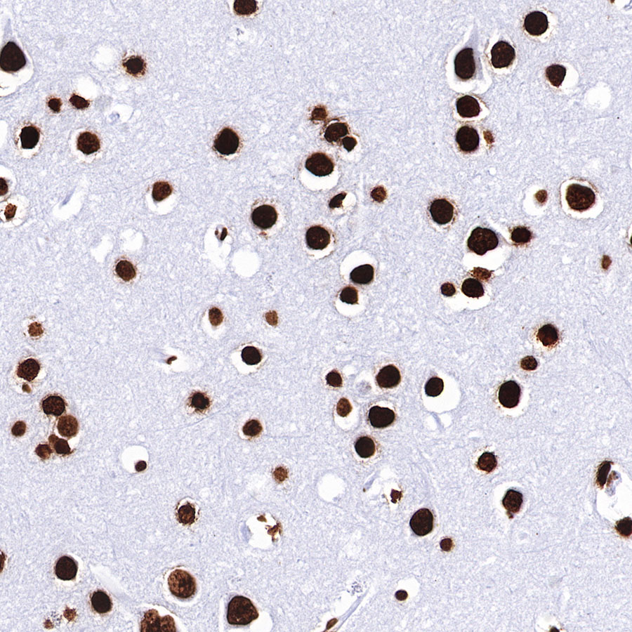 Rabbit anti-H3K27me3 Recombinant Monoclonal Antibody(431-118)