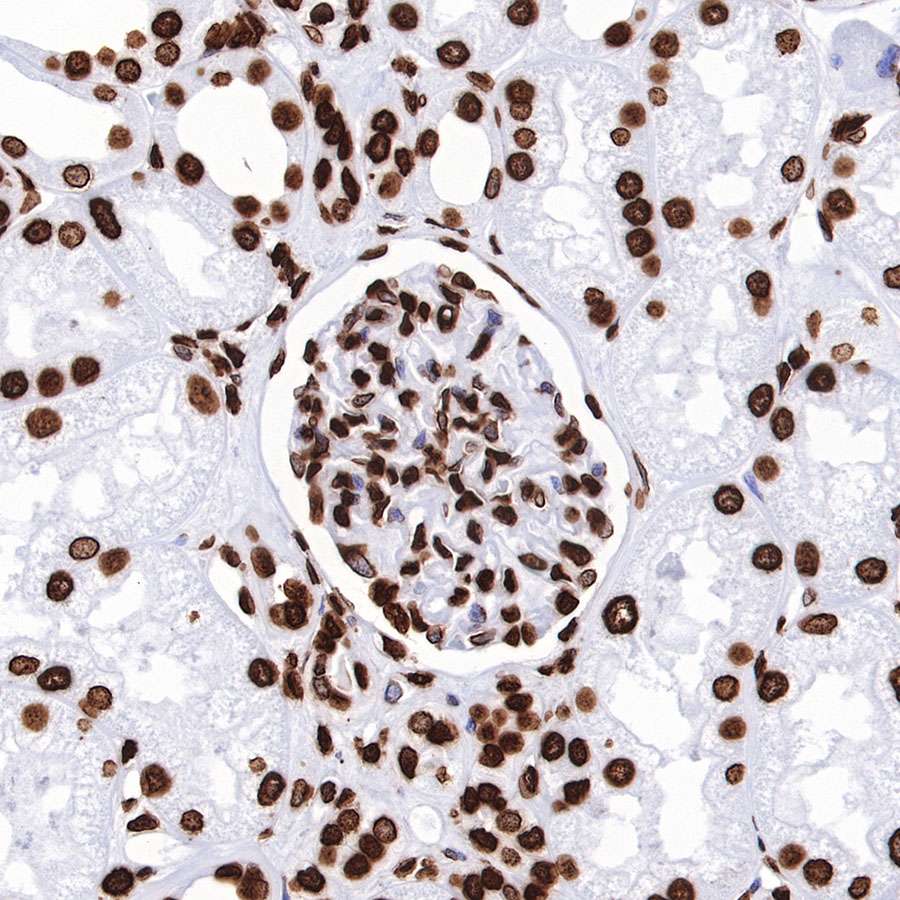 Rabbit anti-H3K27me3 Recombinant Monoclonal Antibody(431-118)