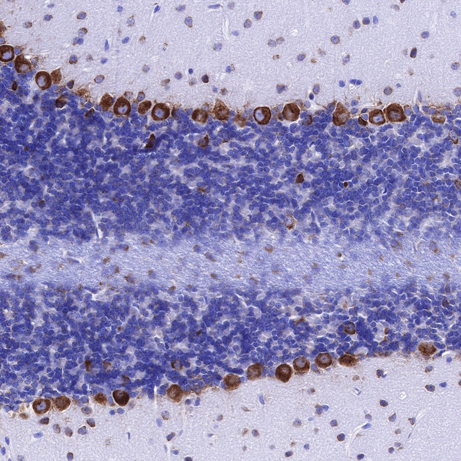 Rabbit anti-S6 Ribosomal Protein Recombinant Monoclonal Antibody(S-479-1)