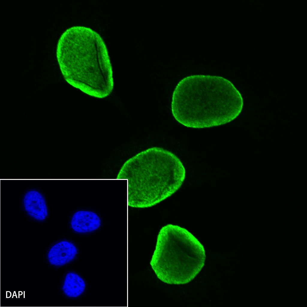 Rabbit anti-H3K27me3 Recombinant Monoclonal Antibody(431-118)
