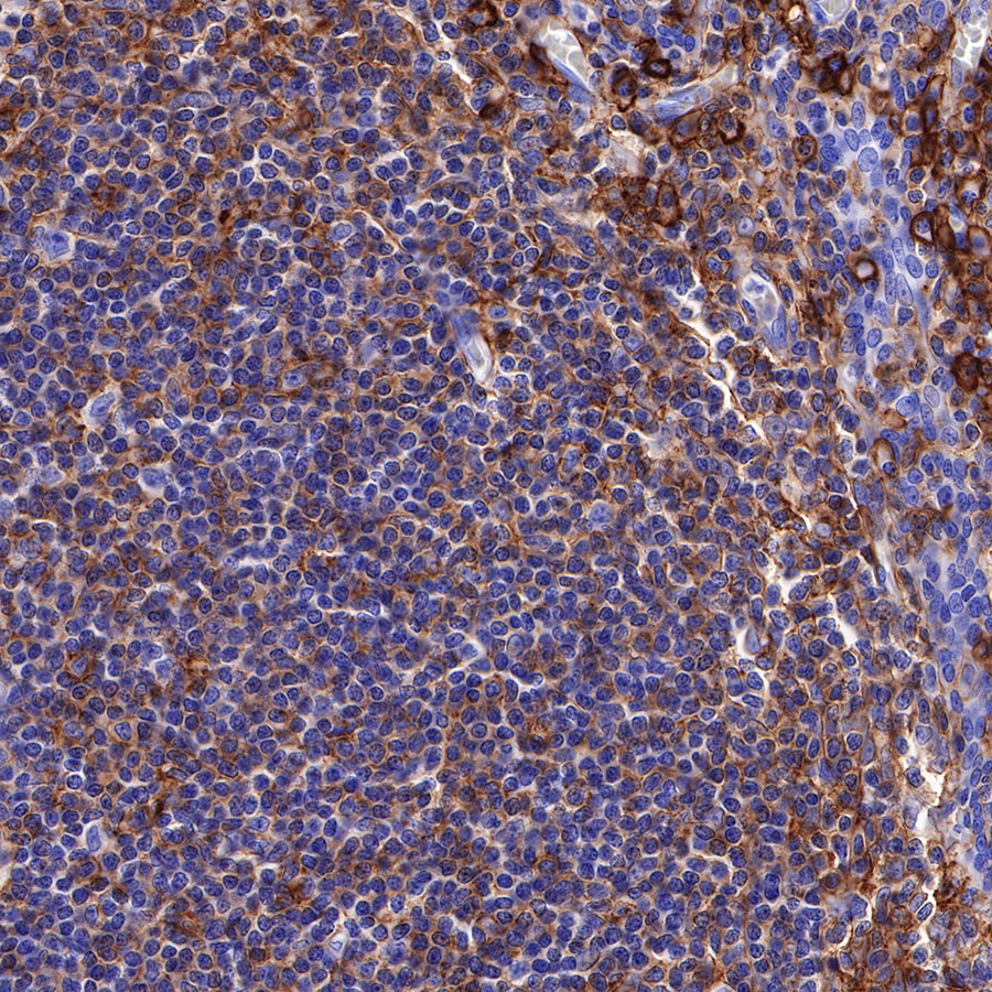Rabbit anti-CD44 Recombinant Monoclonal Antibody(R107)