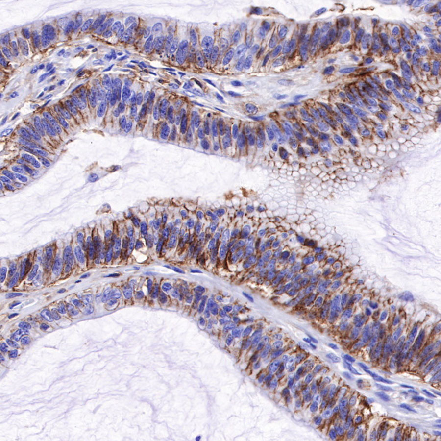 Rabbit anti-CD44 Recombinant Monoclonal Antibody(R107)