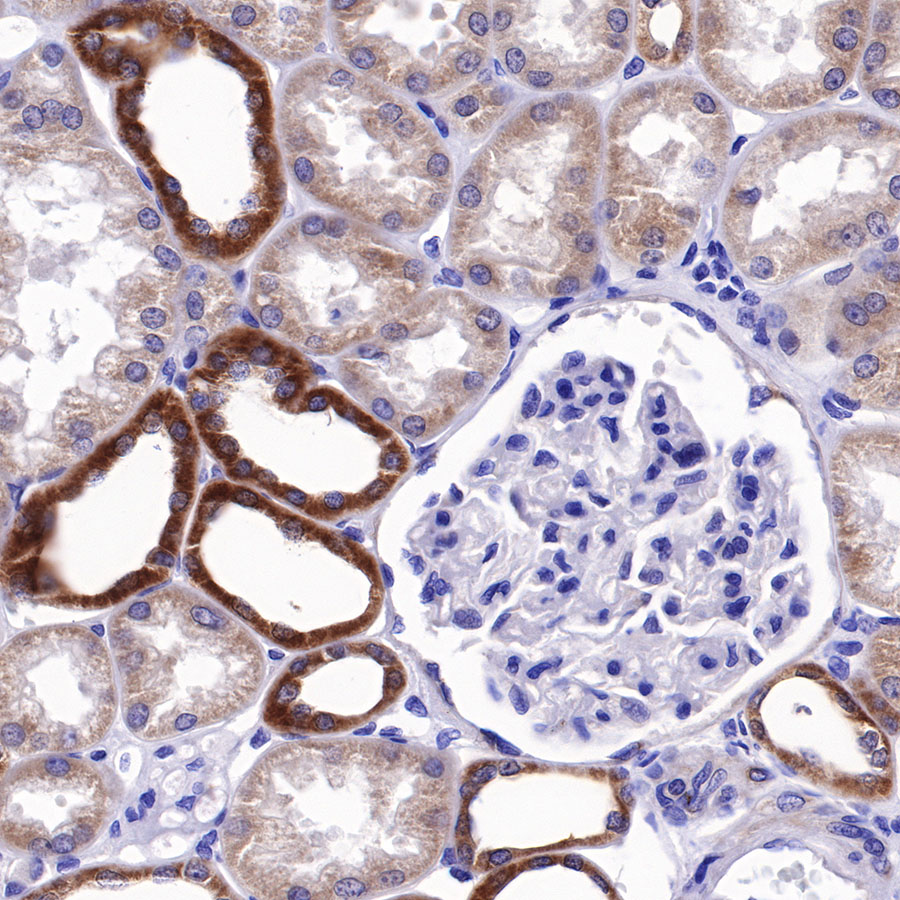 Rabbit anti-Bcl-xL Recombinant Monoclonal Antibody(S-487-28)