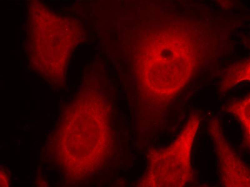 Rabbit anti-Phospho-eIF2α(Ser49) Polyclonal Antibody