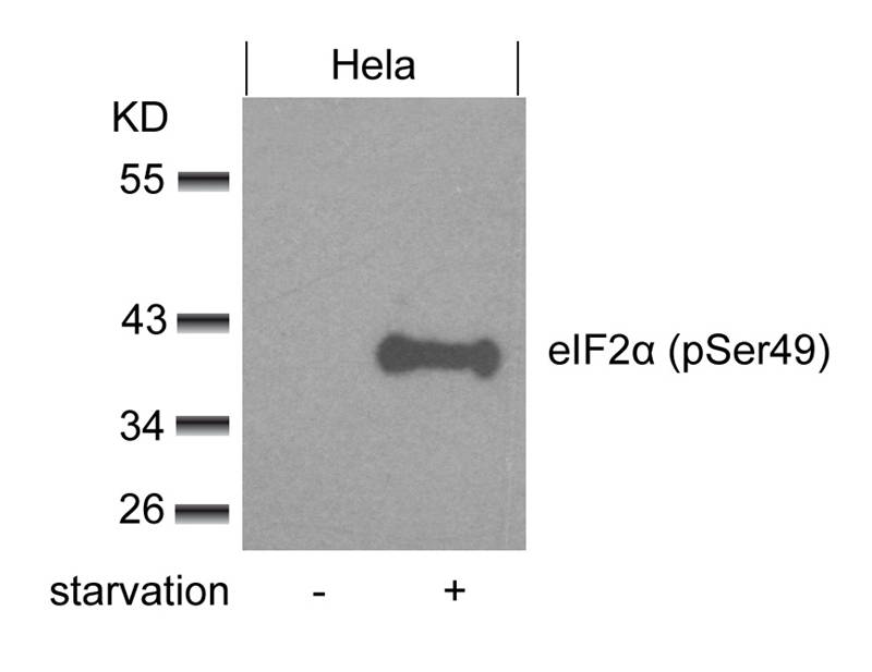 Rabbit anti-Phospho-eIF2α(Ser49) Polyclonal Antibody